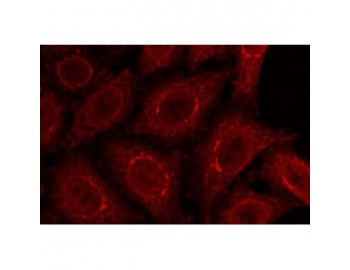 Methanol/acetone fixed HeLa cells stained with rabbit anti gp210