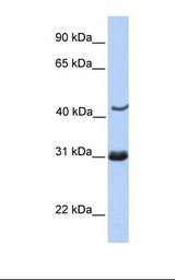 Jurkat cell lysate. Antibody concentration: 1.0 ug/ml. Gel concentration: 12%.