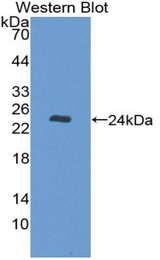 Western blot of recombinant NUP35 / NUP53.