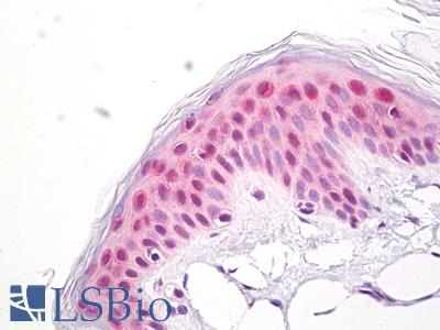 Anti-MP-44 / NUP53 antibody IHC of human skin, epidermis. Immunohistochemistry of formalin-fixed, paraffin-embedded tissue after heat-induced antigen retrieval. Antibody LS-B7978 dilution 10 ug/ml.