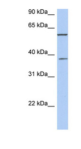 NUP43 antibody LS-C111749 Western blot of Fetal Thymus lysate.
