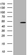 HEK293T cells were transfected with the pCMV6-ENTRY control (Left lane) or pCMV6-ENTRY NUP43 (Right lane) cDNA for 48 hrs and lysed. Equivalent amounts of cell lysates (5 ug per lane) were separated by SDS-PAGE and immunoblotted with anti-NUP43.