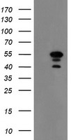 HEK293T cells were transfected with the pCMV6-ENTRY control (Left lane) or pCMV6-ENTRY MEIS3 (Right lane) cDNA for 48 hrs and lysed. Equivalent amounts of cell lysates (5 ug per lane) were separated by SDS-PAGE and immunoblotted with anti-MEIS3.