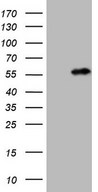 HEK293T cells were transfected with the pCMV6-ENTRY control (Left lane) or pCMV6-ENTRY NUP43 (Right lane) cDNA for 48 hrs and lysed. Equivalent amounts of cell lysates (5 ug per lane) were separated by SDS-PAGE and immunoblotted with anti-NUP43 (1:2000).