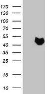 HEK293T cells were transfected with the pCMV6-ENTRY control (Left lane) or pCMV6-ENTRY NUP43 (Right lane) cDNA for 48 hrs and lysed. Equivalent amounts of cell lysates (5 ug per lane) were separated by SDS-PAGE and immunoblotted with anti-NUP43.