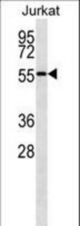 NUP50 western blot of Jurkat cell line lysates (35 ug/lane). The NUP50 antibody detected the NUP50 protein (arrow).