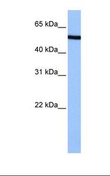 HepG2 cell lysate. Antibody concentration: 0.5 ug/ml. Gel concentration: 12%.