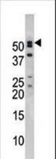 Western blot of anti-NUP50 antibody in mouse brain tissue lysate. NUP50(arrow) was detected using the purified antibody.