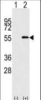 Western blot of NUP50 (arrow) using rabbit polyclonal NUP50 Antibody (RB08362). 293 cell lysates (2 ug/lane) either nontransfected (Lane 1) or transiently transfected with the NUP50 gene (Lane 2) (Origene Technologies).