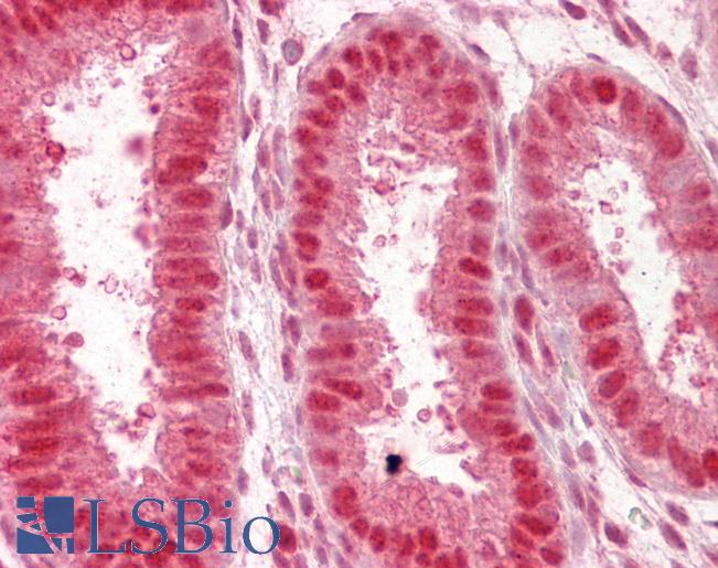 Anti-NUP50 antibody IHC of human uterus. Immunohistochemistry of formalin-fixed, paraffin-embedded tissue after heat-induced antigen retrieval. Antibody LS-B6451 concentration 2.5 ug/ml.