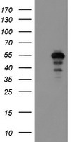 HEK293T cells were transfected with the pCMV6-ENTRY control (Left lane) or pCMV6-ENTRY MEIS3 (Right lane) cDNA for 48 hrs and lysed. Equivalent amounts of cell lysates (5 ug per lane) were separated by SDS-PAGE and immunoblotted with anti-MEIS3.