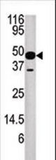 Western blot of anti-NUP54 antibody in mouse heart tissue lysate.NUP54(arrow) was detected using the purified antibody.