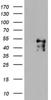 HEK293T cells were transfected with the pCMV6-ENTRY control (Left lane) or pCMV6-ENTRY MEIS3 (Right lane) cDNA for 48 hrs and lysed. Equivalent amounts of cell lysates (5 ug per lane) were separated by SDS-PAGE and immunoblotted with anti-MEIS3.