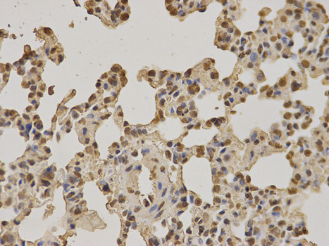 Immunohistochemistry of paraffin-embedded rat lung using NUP62 antibody at dilution of 1:100 (400x lens).