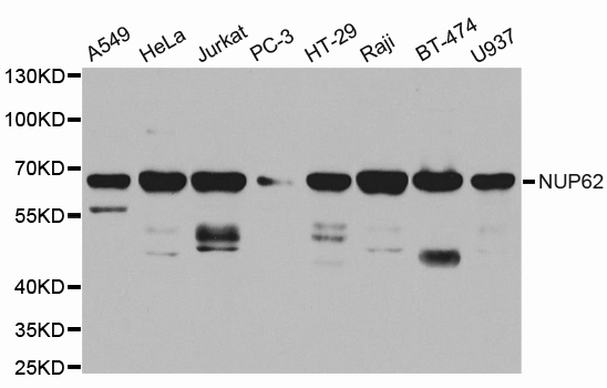 Western blot analysis of extracts of various cell lines, using NUP62 antibody.