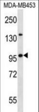 NUP88 Antibody western blot of MDA-MB453 cell line lysates (35 ug/lane). The NUP88 antibody detected the NUP88 protein (arrow).