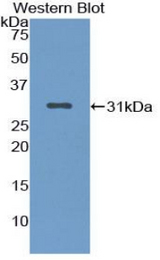 Western blot of recombinant NUP88.