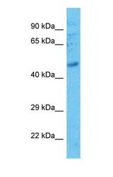 Western blot of NUP88 Antibody with human Jurkat Whole Cell lysate.