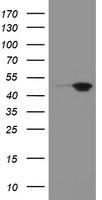 HEK293T cells were transfected with the pCMV6-ENTRY control (Left lane) or pCMV6-ENTRY MEIS3 (Right lane) cDNA for 48 hrs and lysed. Equivalent amounts of cell lysates (5 ug per lane) were separated by SDS-PAGE and immunoblotted with anti-MEIS3.