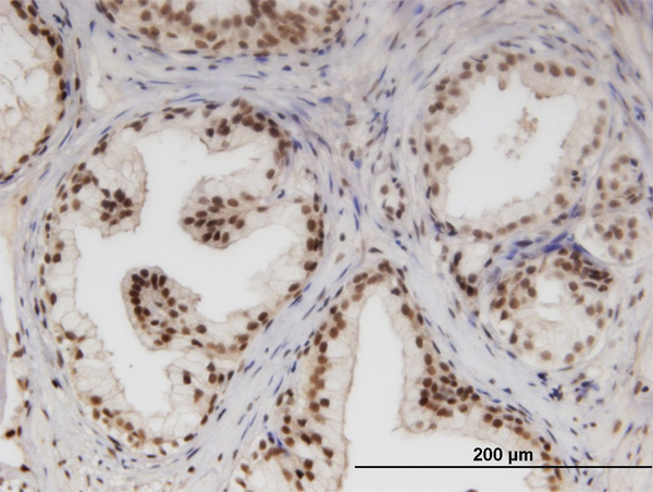 Immunoperoxidase of monoclonal antibody to NUPL1 on formalin-fixed paraffin-embedded human prostate. [antibody concentration 3 ug/ml]
