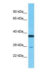 Western blot of NUPL2 Antibody with human HCT15 Whole Cell lysate.