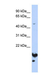 NUSAP1 antibody LS-C110872 Western blot of HepG2 cell lysate.