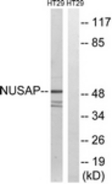 Western blot of extracts from HT-29 cells, using NUSAP1 Antibody. The lane on the right is treated with the synthesized peptide.