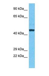 Western blot of NUSAP Antibody with human Fetal Liver lysate.