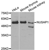 Western blot analysis of extracts of various cell lines, using NUSAP1 antibody.