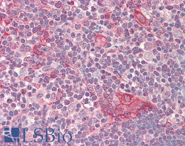 Anti-NUSAP1 / NUSAP antibody IHC staining of human thymus. Immunohistochemistry of formalin-fixed, paraffin-embedded tissue after heat-induced antigen retrieval. Antibody LS-B10317 concentration 5 ug/ml.