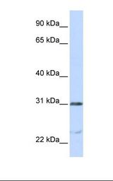 Jurkat cell lysate. Antibody concentration: 1.0 ug/ml. Gel concentration: 12%.