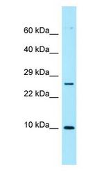 NUTF2 / PP15 antibody Western Blot of ACHN.