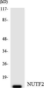 Western blot of the lysates from HT-29 cells using NUTF2 antibody.