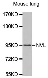 Western blot analysis of extracts of Mouse lung cell lines, using NVL antibody.