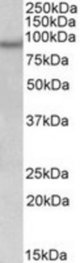 NPAS4 antibody (0.3 ug/ml) staining of Human Frontal Cortex lysate (35 ug protein/ml in RIPA buffer). Primary incubation was 1 hour. Detected by chemiluminescence.