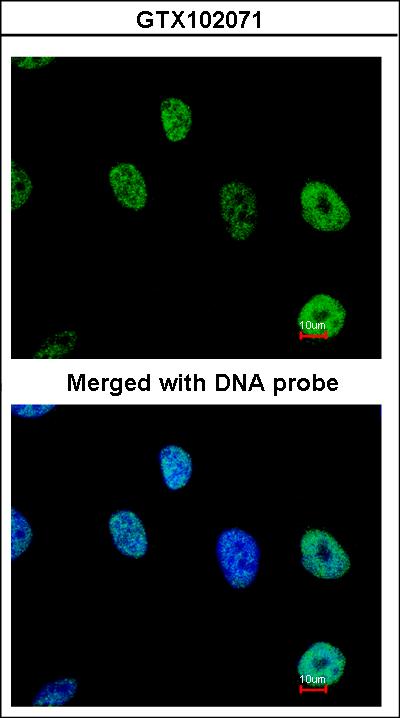 Immunofluorescence of paraformaldehyde-fixed HeLa using TAP antibody at 1:200 dilution.