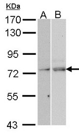 Sample (30 ug of whole cell lysate). A: Hela, B: Molt-4 . 7.5% SDS PAGE. NXF1 / TAP antibody diluted at 1:1000.