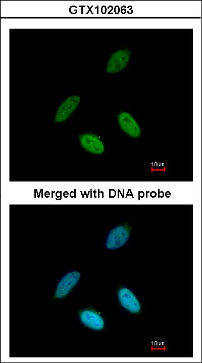 Immunofluorescence of paraformaldehyde-fixed HeLa using TAP antibody at 1:200 dilution.