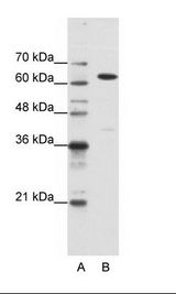A: Marker, B: HepG2 Cell Lysate