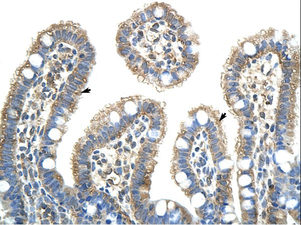 NXF5 antibody LS-C31603 was used in IHC to stain formalin-fixed, paraffin-embedded human intestine.