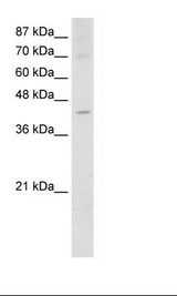 Jurkat Cell Lysate