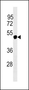 NXF5 Antibody western blot of Jurkat cell line lysates (35 ug/lane). The NXF5 Antibody detected the NXF5 protein (arrow).
