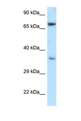 NXN antibody LS-C145653 Western blot of H226 Cell lysate. Antibody concentration 1 ug/ml.