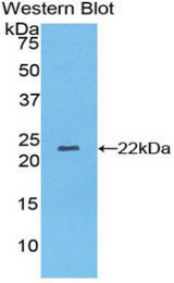 Western blot of recombinant NXN.