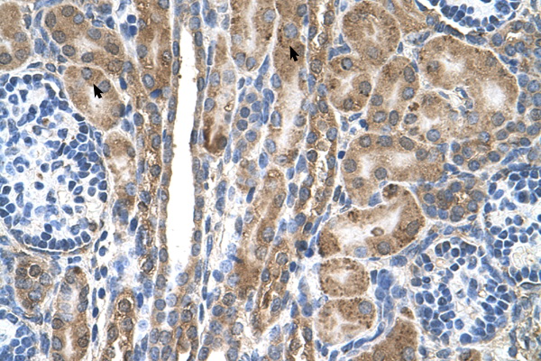 FAM55D antibody LS-C40508 IHC of formalin-fixed, paraffin-embedded human Kidney. Positive label: Epithelial cells of renal tubule indicated with arrows. Antibody concentration 4-8 ug/ml. Magnification 400X.