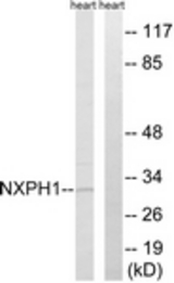 Western blot of extracts from rat heart cells, using NXPH1 Antibody. The lane on the right is treated with the synthesized peptide.