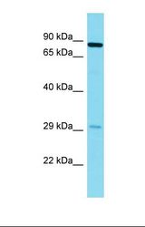 Western blot of Human Fetal Lung. NYAP2 antibody dilution 1.0 ug/ml.