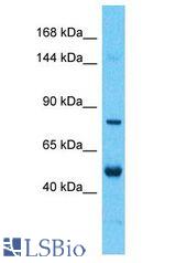 NYAP2 antibody Western Blot of Thymus Tumor. Antibody dilution: 1 ug/ml.