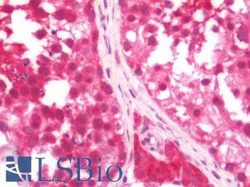 Human Testis: Formalin-Fixed, Paraffin-Embedded (FFPE)