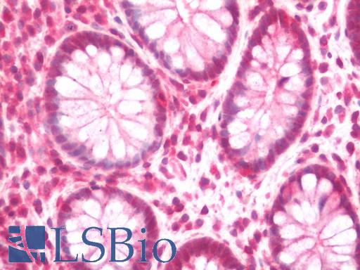 Human Colon: Formalin-Fixed, Paraffin-Embedded (FFPE)